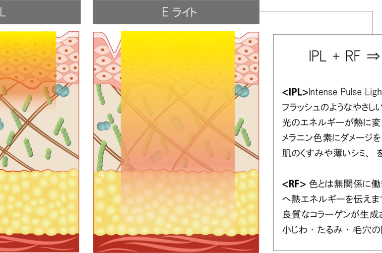 Eライトイメージ